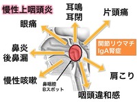 上咽頭