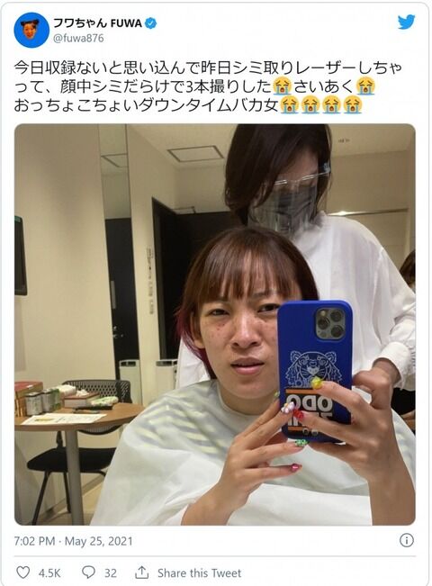 フワちゃん シミ取りレーザー直後の顔を公開 ダウンタイムバカ女 と自虐 ミラクルミルク フワちゃん シミ取りレーザー直後の顔を公開 ダウンタイムバカ女 と自虐 ミラクルミルク