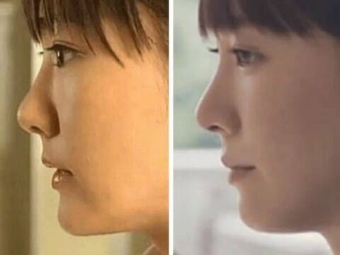 豚鼻 豚鼻