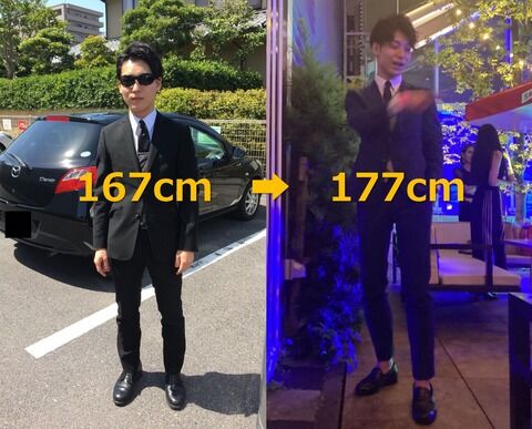 朗報 手術で身長を10cm延ばした男 めちゃくちゃスーツが似合うようになる 画像あり ミラクルミルク 朗報 手術で身長を10cm延ばした男 めちゃくちゃスーツが似合うようになる 画像あり ミラクルミルク
