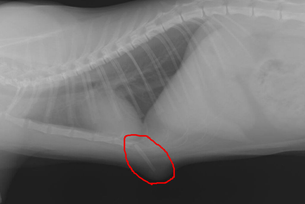 は と 剣 突起 状 腹膜鞘状突起