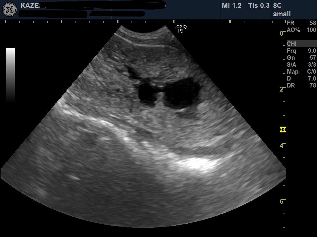 見逃されやすいかも 前立腺疾患と前立腺膿瘍 風の動物病院のブログ 見逃されやすいかも 前立腺疾患と前立腺膿瘍 風の動物病院のブログ