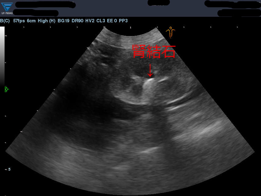 なぜ引っ張る？ ～猫の腎結石と尿管結石 前編～ : 風の動物病院のブログ