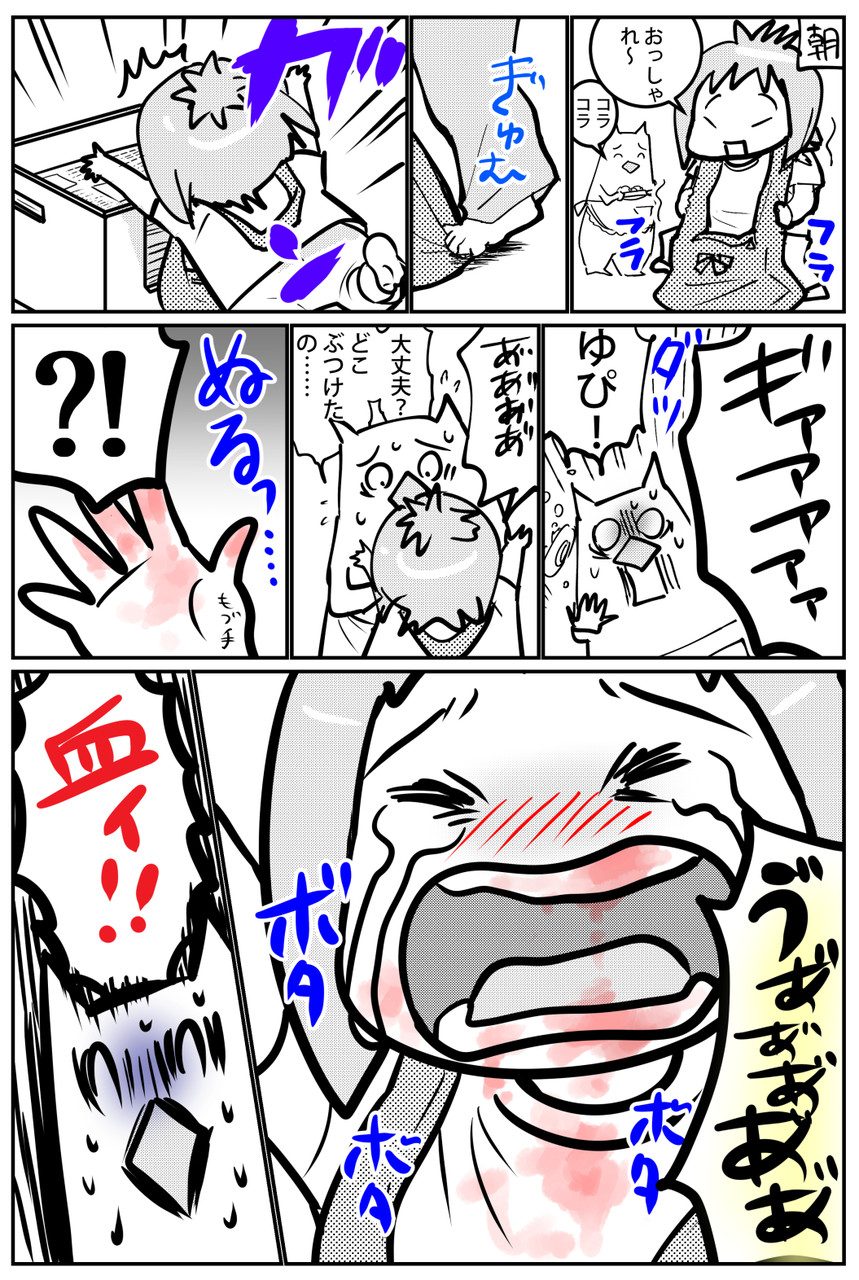 幼児が口の中をケガ その時親は 注 ちょと痛々しい表現あります むすめ雑記帳 Powered By ライブドアブログ 幼児が口の中をケガ その時親は 注 ちょと痛々しい表現あります むすめ雑記帳 Powered By ライブドアブログ