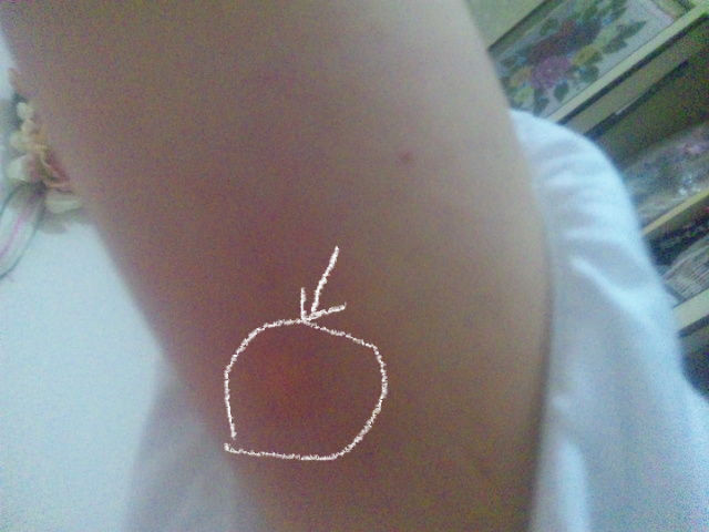 二の腕に違和感 と思ったら 乳がん日記 ひとりごと ｂｙ みりるー