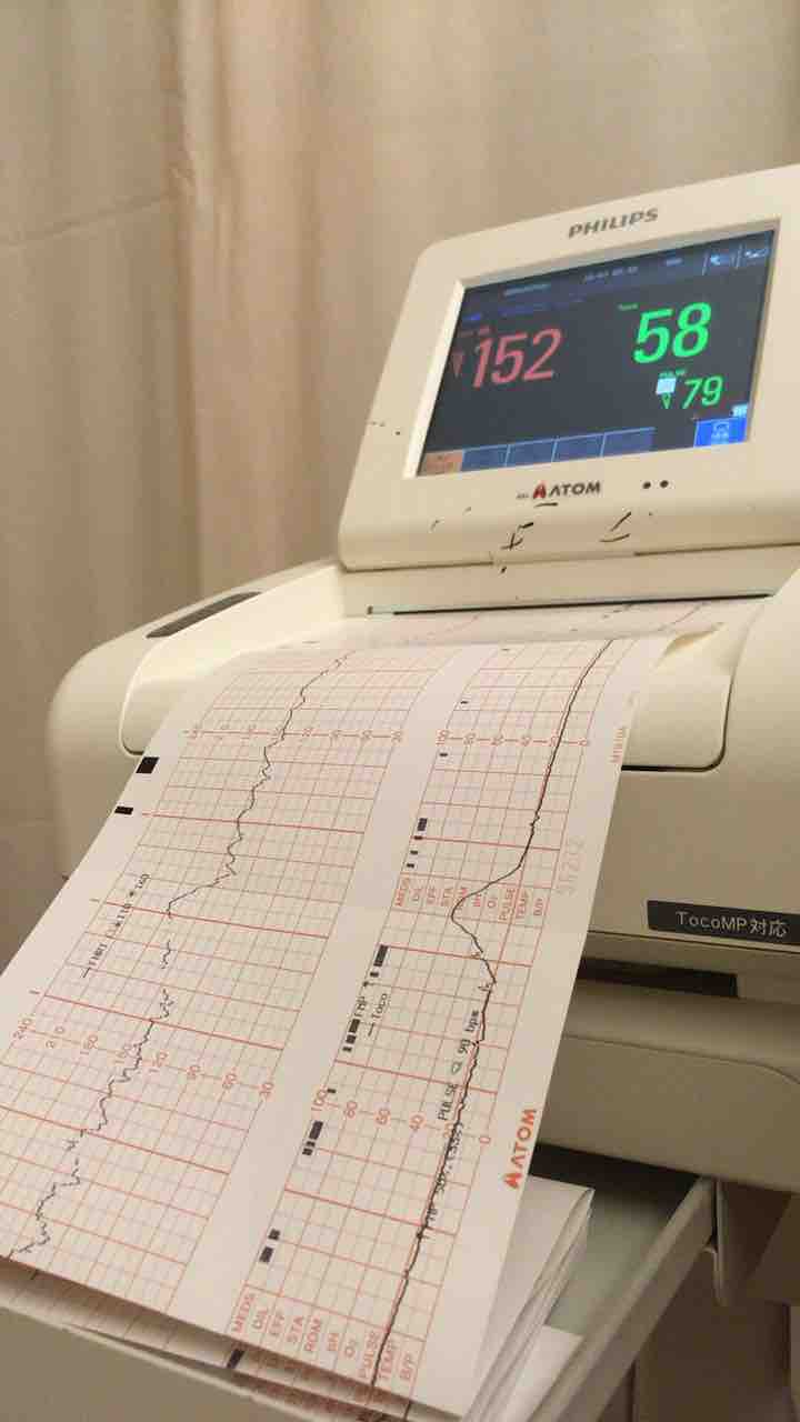 妊娠30週 5分間隔のお腹の張り 妊娠した日から思い立って書き始めた日記