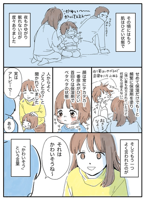  アトピー肌の娘1