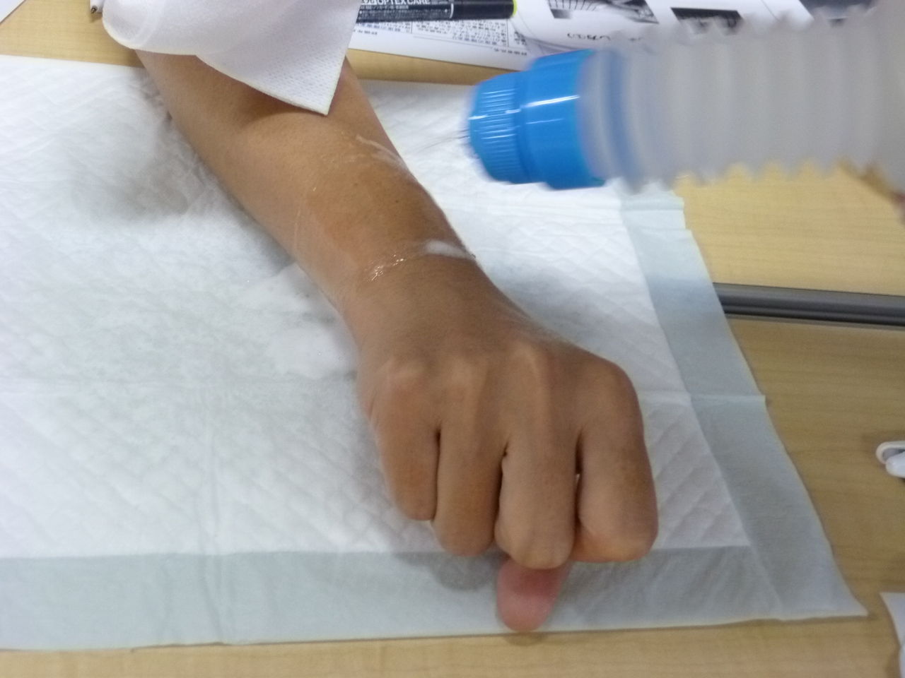 皮膚剥離処置 | 高齢者皮膚剥離処置 – ITWL