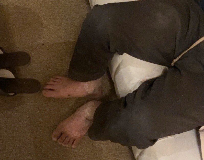 壊死ニキ２ 風俗嬢 初めてこんなに汚い人見た 野グソくほう