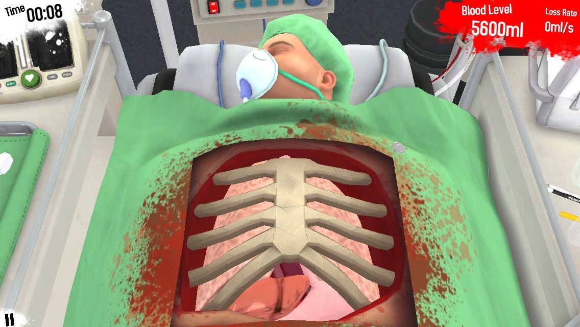 Iphoneで手術シミュレーション バカゲー Surgeon Simulator Club Smoke