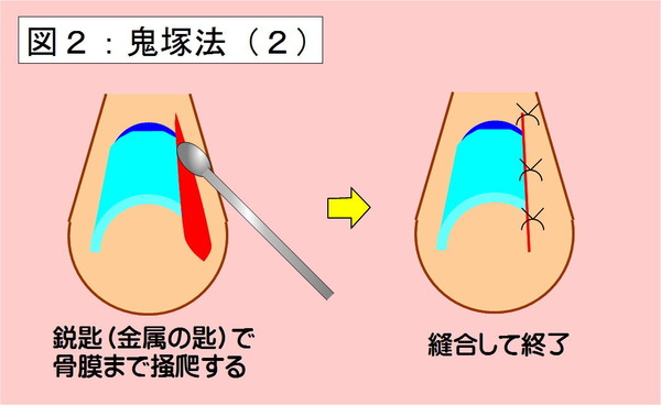 鬼塚法-02