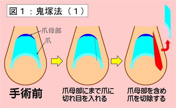 鬼塚法-01