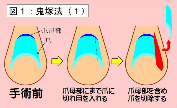 鬼塚法-01