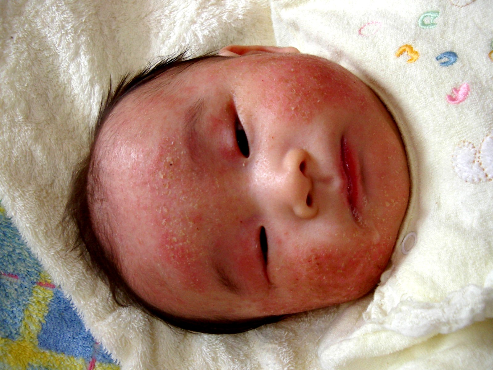 たから生後3ヶ月 食物アレルギー子どもの食事と育児 食育