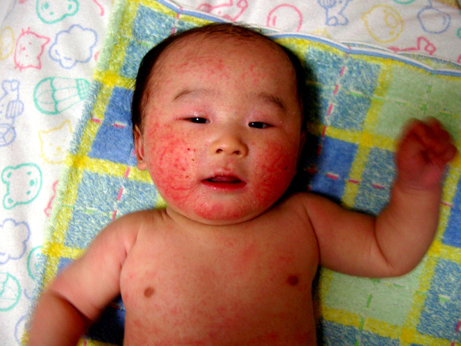 生後4ヶ月目 食物アレルギー子どもの食事と育児 食育