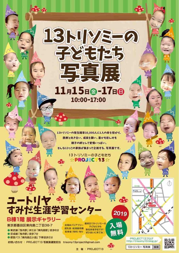 13トリソミーの子どもたち写真展 開催のお知らせ 13トリソミーの