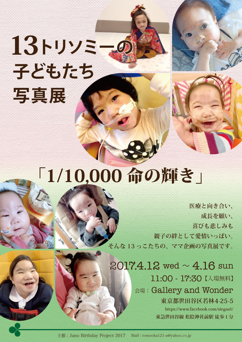 13トリソミーの子どもたち写真展開催 13トリソミーの子どもたち