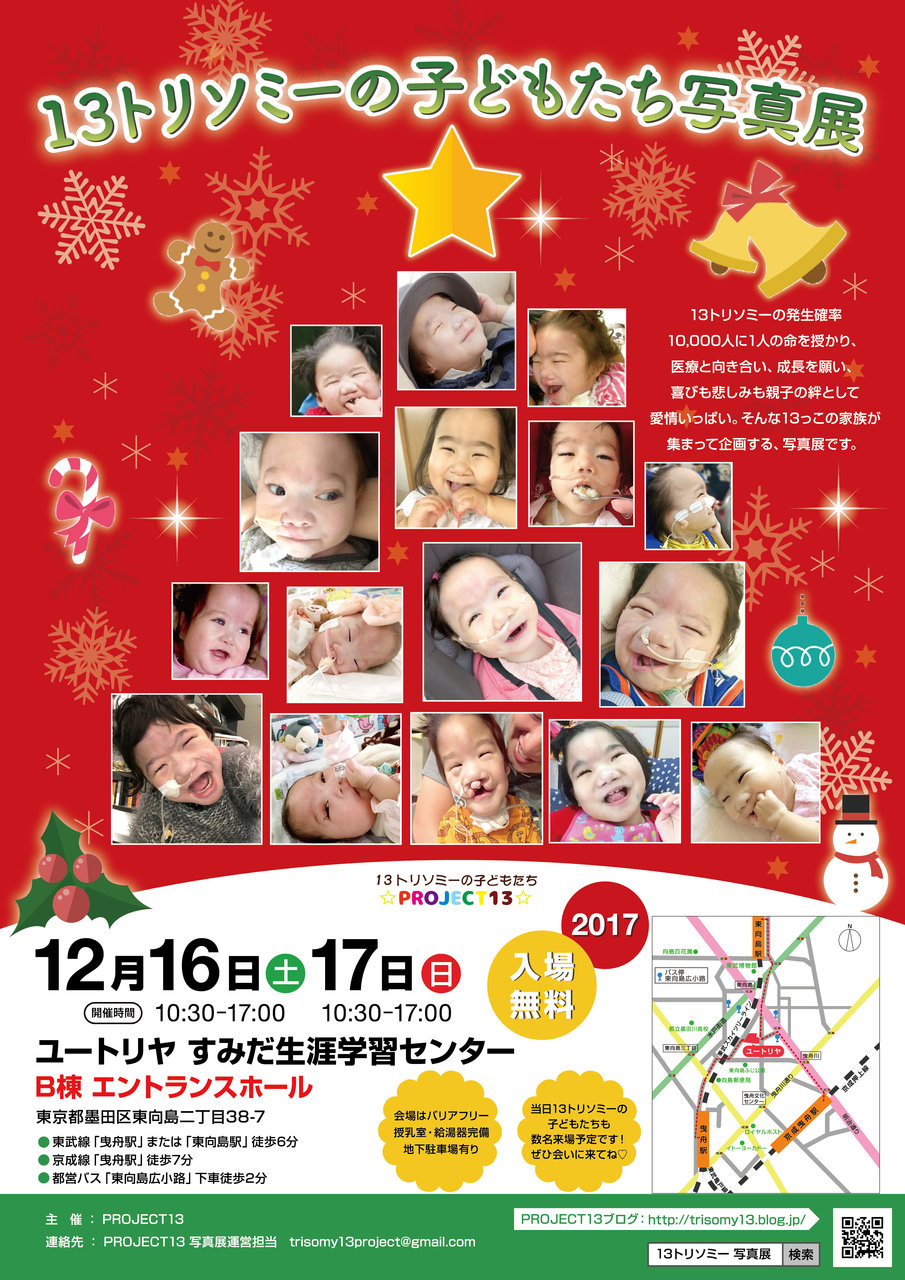 プレスリリース 13トリソミーの子どもたち写真展開催のお知らせ 13