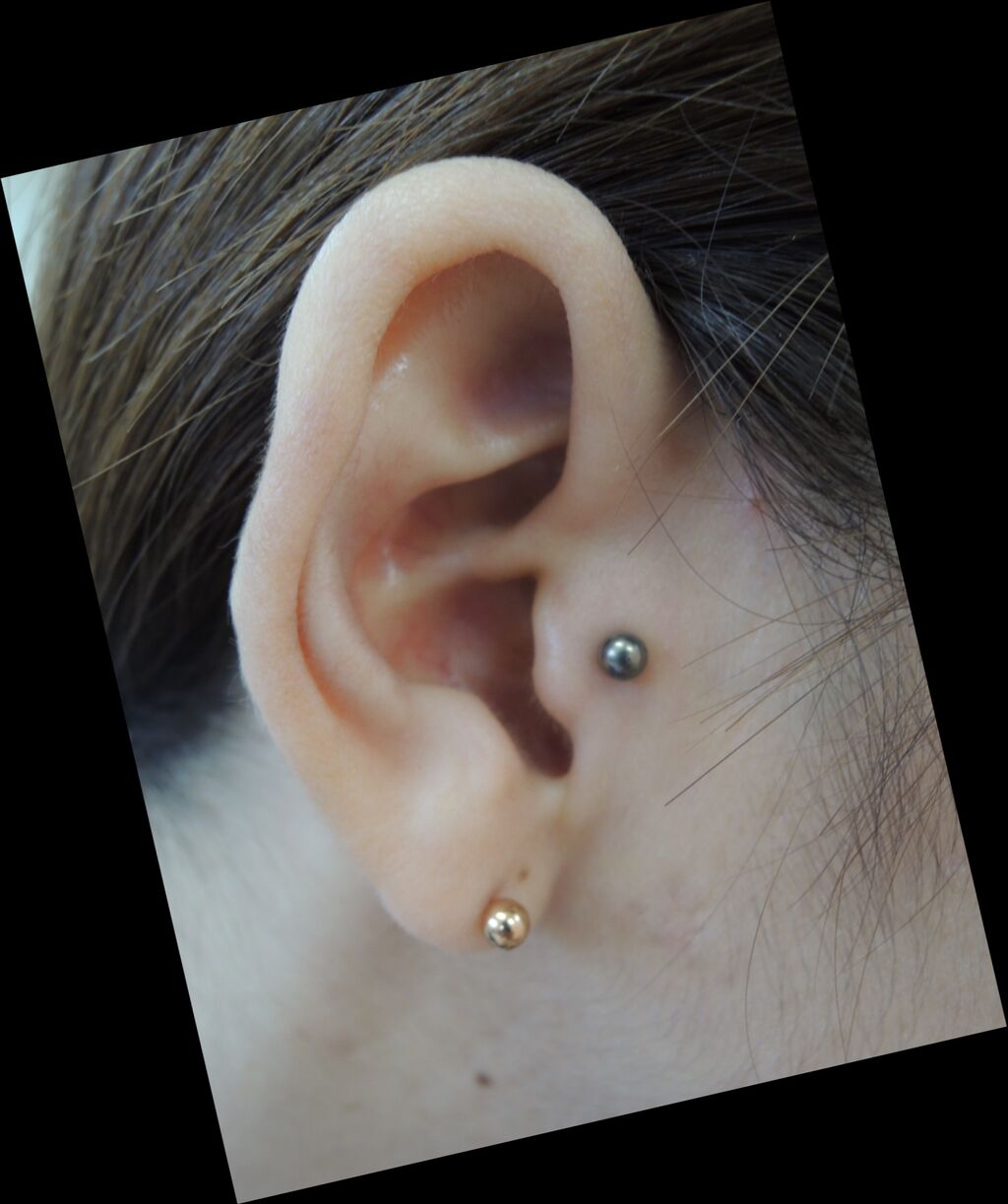 トラガス 耳珠 10 15 医療法人 みずほ整形外科のブログ