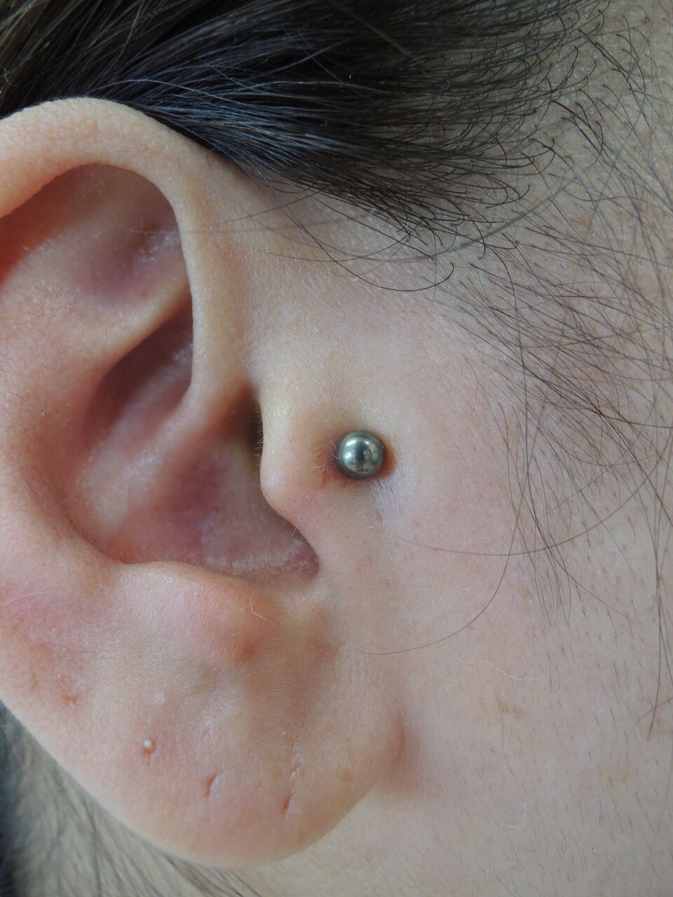 トラガス 耳軟骨ピアス 02 27 医療法人 みずほ整形外科のブログ