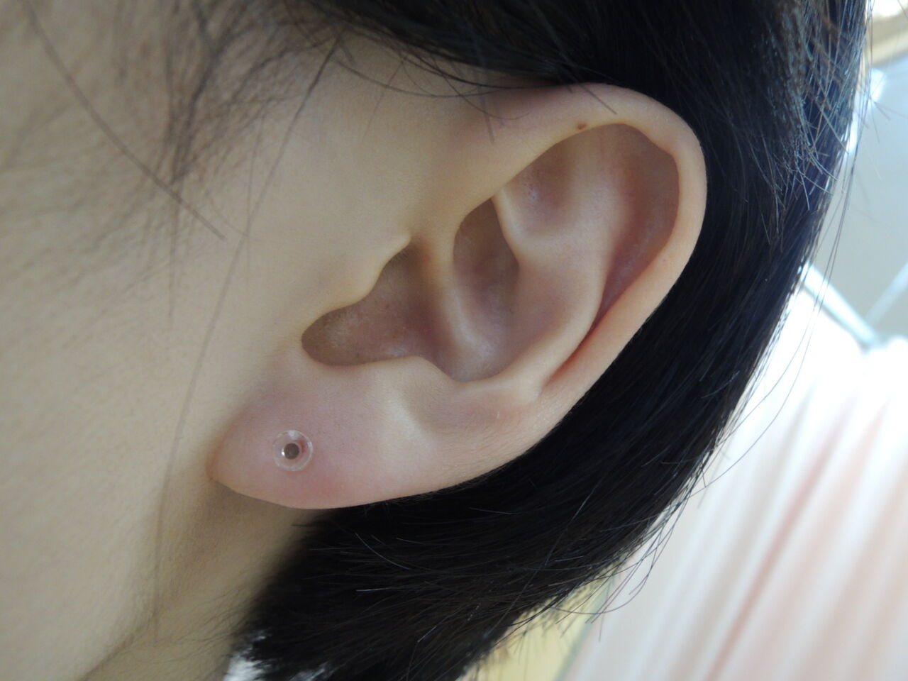 透明樹脂タイプ 11 1 医療法人 みずほ整形外科のブログ