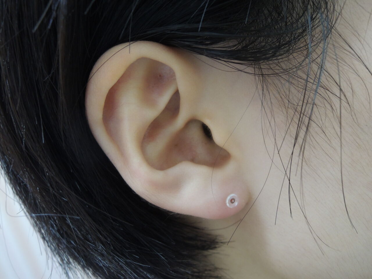 透明樹脂タイプ 11 1 医療法人 みずほ整形外科のブログ