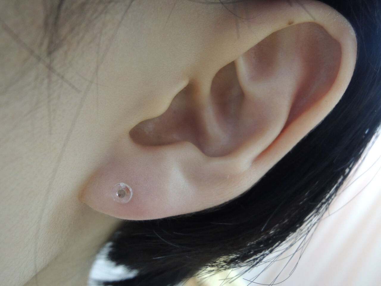 透明樹脂タイプ 11 1 医療法人 みずほ整形外科のブログ