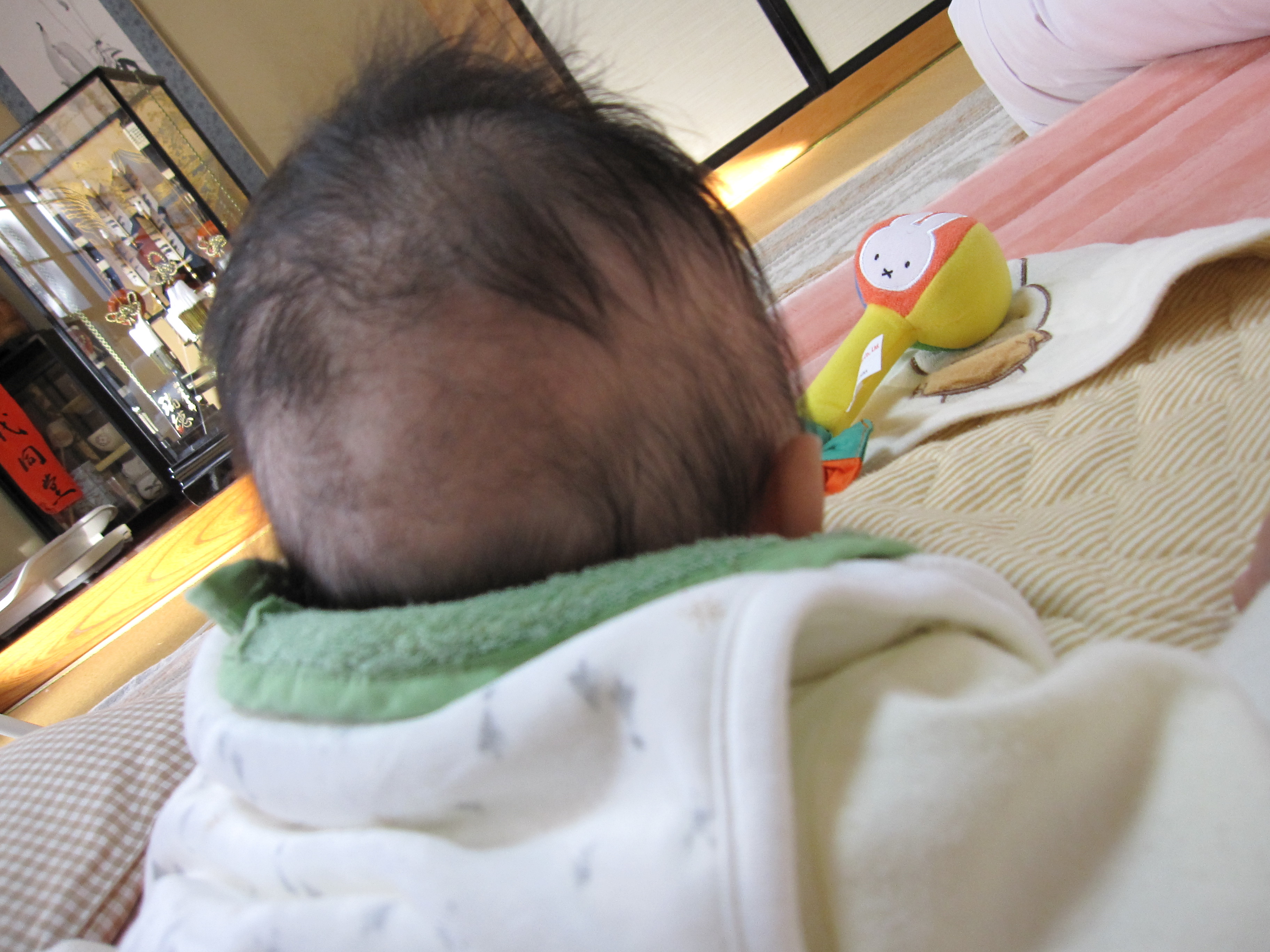 赤ちゃん はげる 子供にハゲがある 考えられる原因と治療法