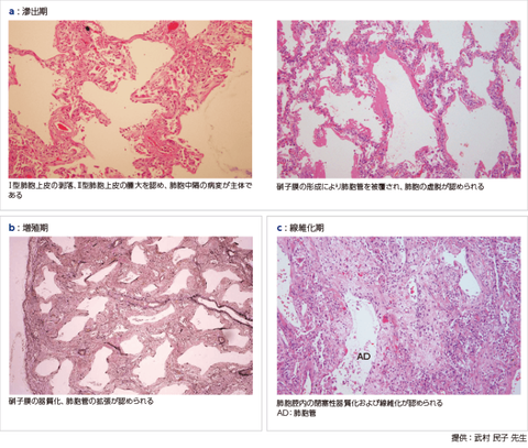 補体依存性細胞傷害