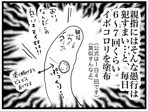 尋常性疣贅 ミズムリズム Powered By ライブドアブログ 尋常性疣贅 ミズムリズム Powered By ライブドアブログ