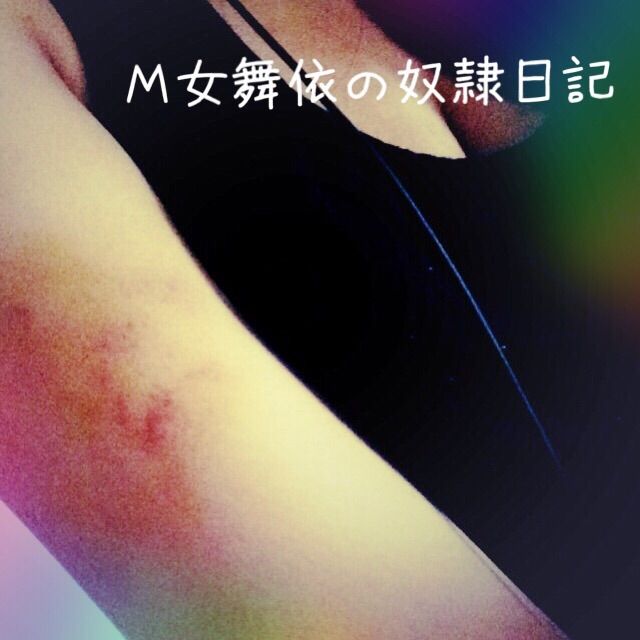 二の腕の痣 ｍ女舞依の奴隷日記