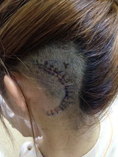 術後4日目 初シャンプー みぃちゃん 聴神経腫瘍体験