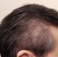 thumbnail_IMG20221113021002