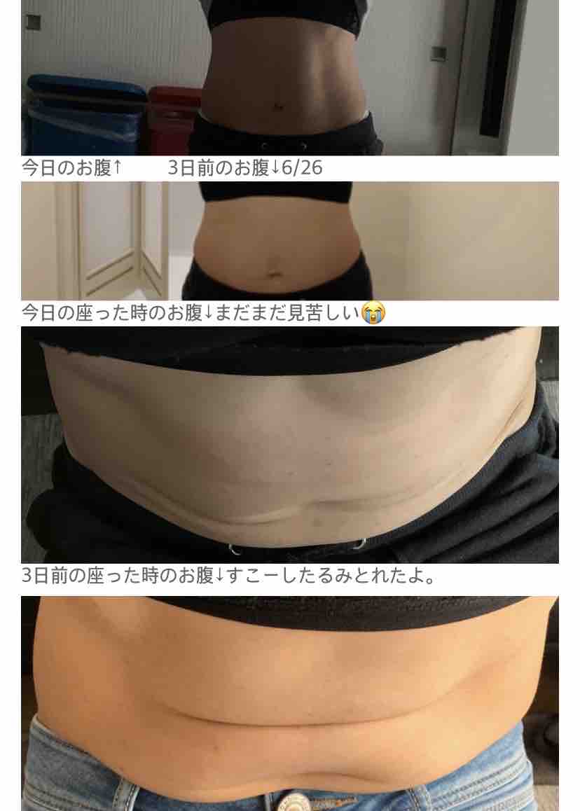 6 29 今日のお腹 ぶよぶよお腹をどうにかしたい 6 29 今日のお腹 ぶよぶよお腹をどうにかしたい