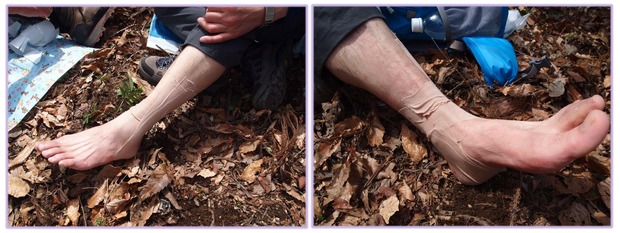 実践テーピング講座：足首