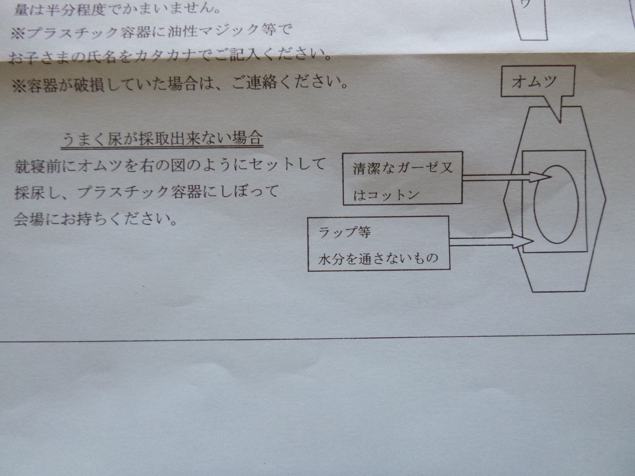 オムツをしている乳幼児の採尿検査 ほぼ確実にとれる方法は もちぱぱcafe オムツをしている乳幼児の採尿検査 ほぼ確実にとれる方法は もちぱぱcafe