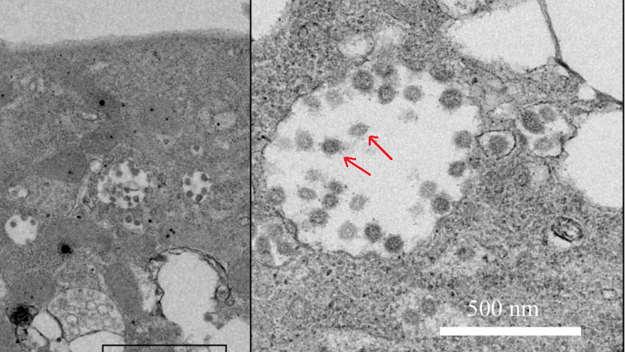 漫画 感想 ﾈﾀﾊﾞﾚ 須賀原洋行 公務員も副業okな時代か もぇもぇあにめちゃんねる