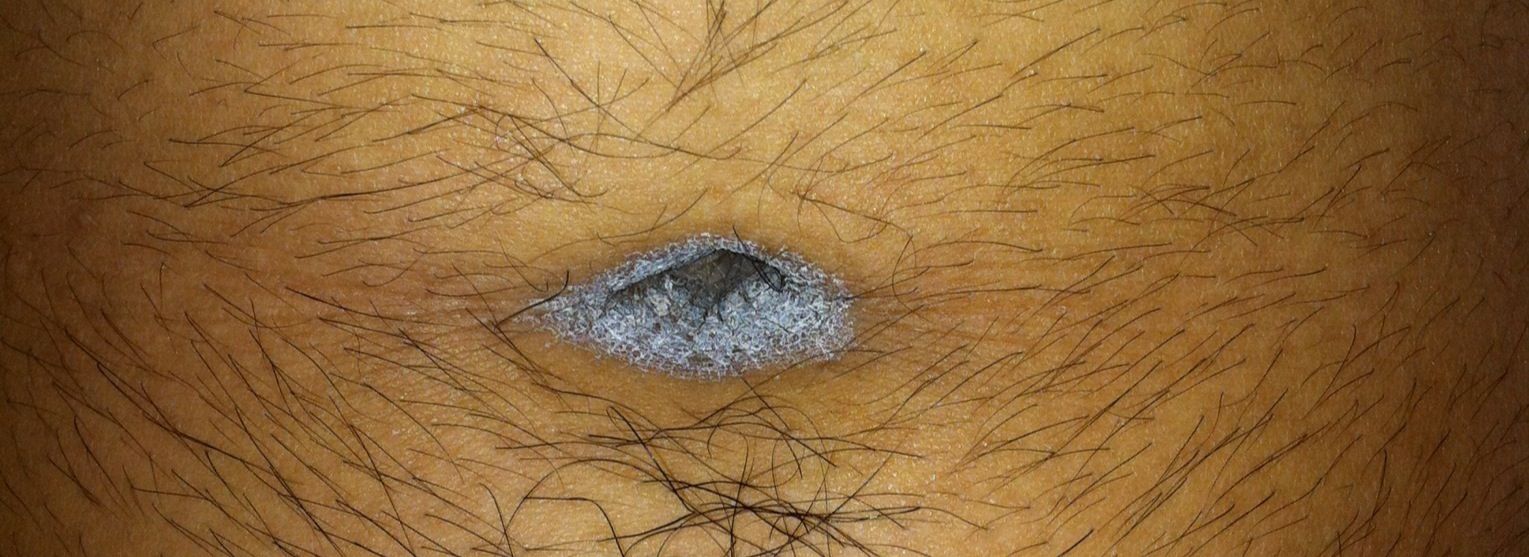 キブ速 速報 俺のヘソがガチでやばい