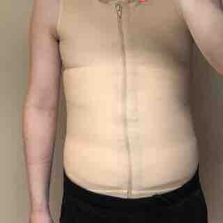 18年08月07日 男の脂肪吸引体験日記