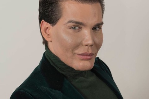 PROD-Rodrigo-Alves-305K-of-cosmetic-surgery