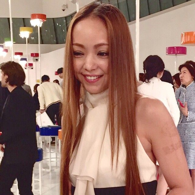 最近やや太り気味の安室奈美恵 タトゥーを除去したとの噂 魅惑のスタア