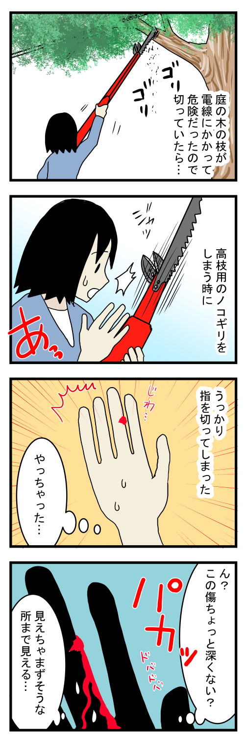 手の傷