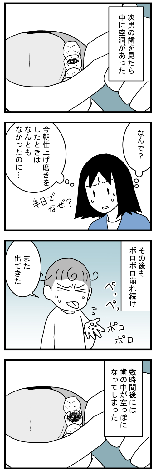 歯医者の話