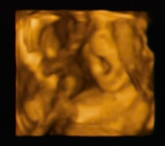 23w2d 4d超音波外来で性別判明 夫と娘と猫との暮らし