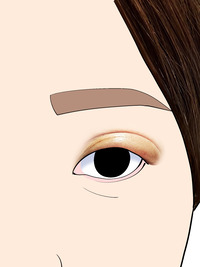 腫