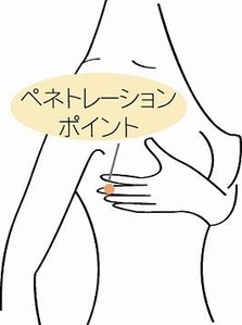 GNバストペネトレーション脇