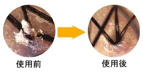 頭皮