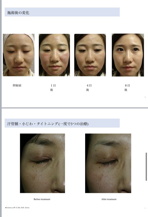 D4080BAF-A442-4C56-99E2-E5AD0F031BE0_1_201_a