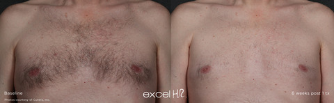 excel_HR_Hair_2