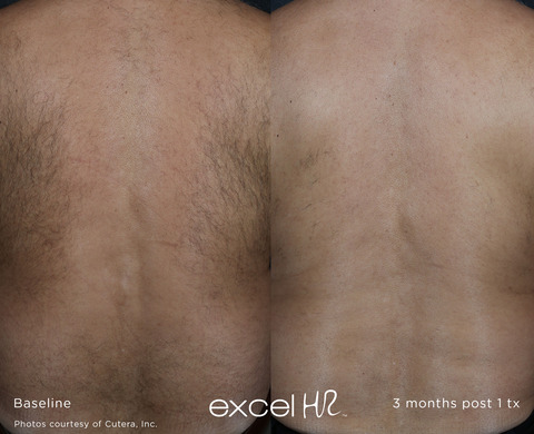 excel_HR_Hair_1